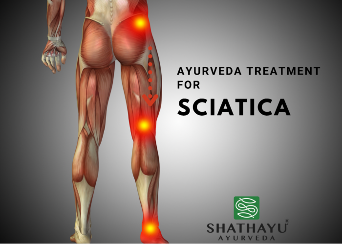 Ayurvedic Treatment for Sciatica Pain