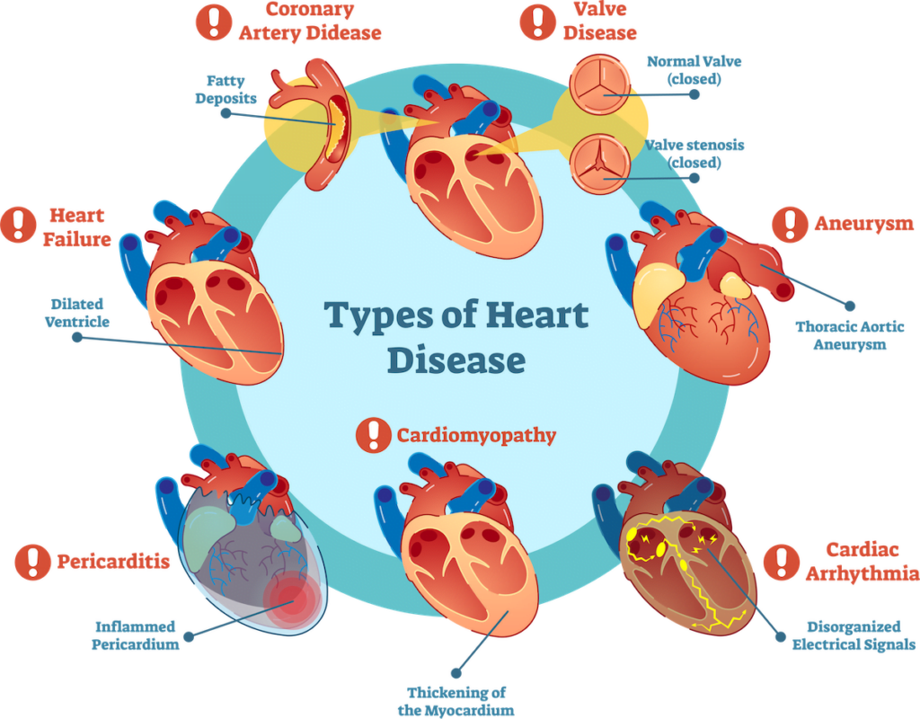 Cardiovascular diseases