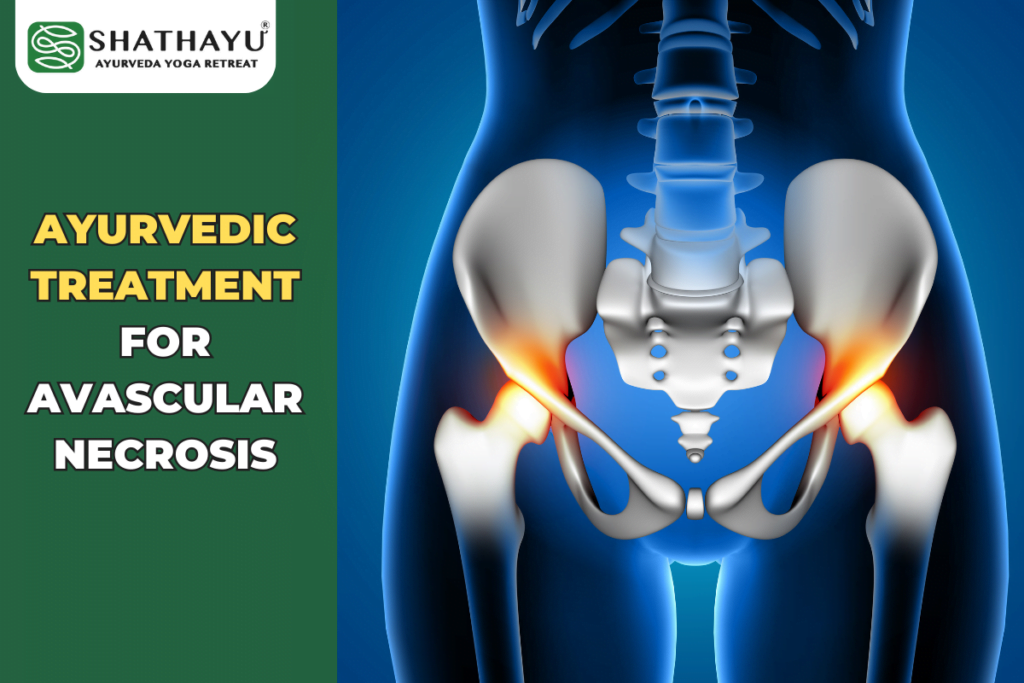 Ayurvedic Treatment for Avascular Necrosis